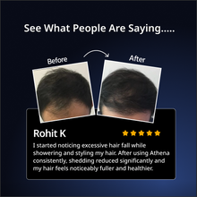 Athena All-in-One Hair Growth Serum with 2% Kera grow & 2% Anagain – 30ml