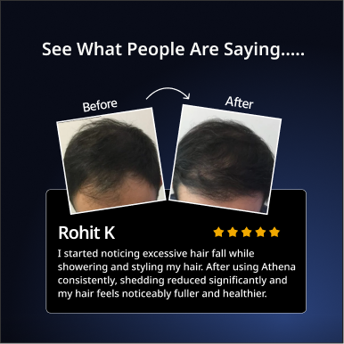 Athena All-in-One Hair Growth Serum with 2% Kera grow & 2% Anagain – 30ml